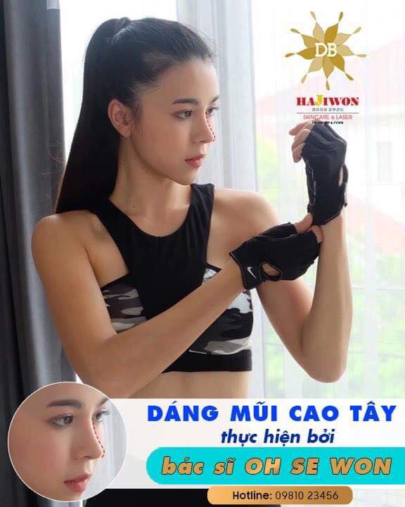 Hiệu quả với phương pháp tiêm Filler